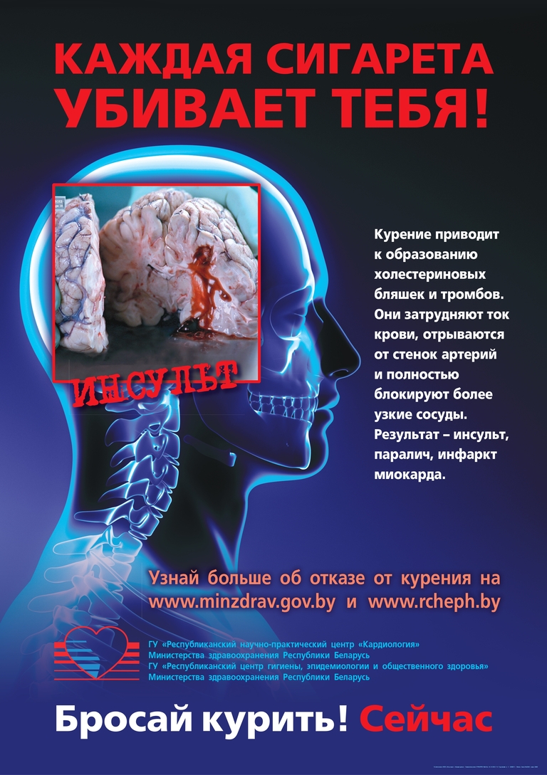 Акция Беларусь против табака